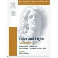 Procedures in Cosmetic Dermatology Series: Lasers and Lights 2