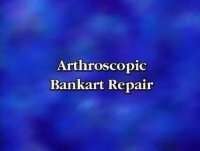 Arthroscopic Bankart Repair — Surgical Technique