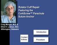 Rotator Cuff Repair Featuring the CorkScrew™ Parachute Suture An