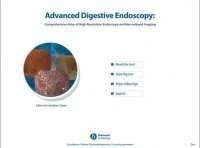 Advanced digestive endoscopy
