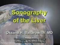 Sonography of the liver