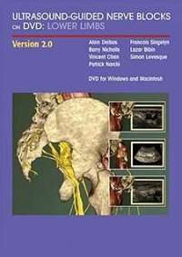 Ultrasound-Guided Nerve Blocks on DVD Lower Limbs