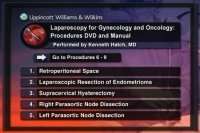 Laparoscopy for gynecology and oncology: Procedures DVD and Manu
