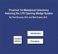 Proximal 1st Metatarsal Osteotomy featuring the LPS Opening Wedg