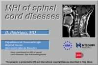 MRI of spinal cord diseases