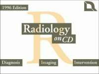 Radiology on CD
