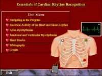 Essentials of Cardiac Rhythm Recognition