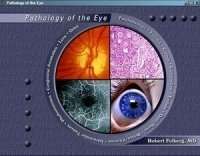 Pathology Of The Eye
