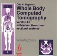 Whole body computed tomography