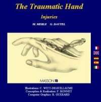 The Traumatic Hand