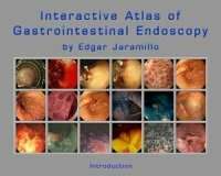 Interactive Atlas of Gastointestional Endoscopy
