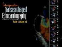 Intraoperative Transesophageal Echocardiography
