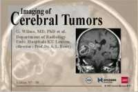 Imaging Of Cerebral Tumors