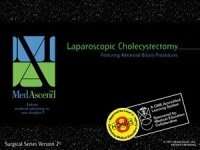 Laparoscopic cholecystectomy featuring advanced biliary procedur