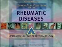 Clinical Slide Collection on the Rheumatic Diseases
