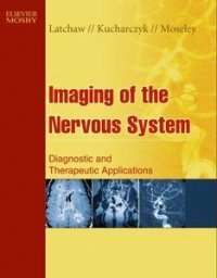 Imaging of the Nervous system