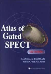 Atlas of gated SPECT