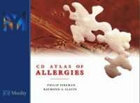 Mosby Atlas of Allergies