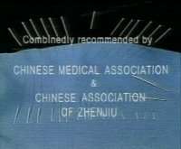 Chinese Acupuncture and Moxibustion Video 4 DVD