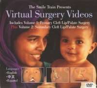 Virtual Surgery Video SmileTrain