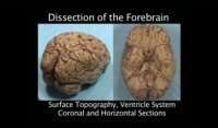 Brain Video Dissections