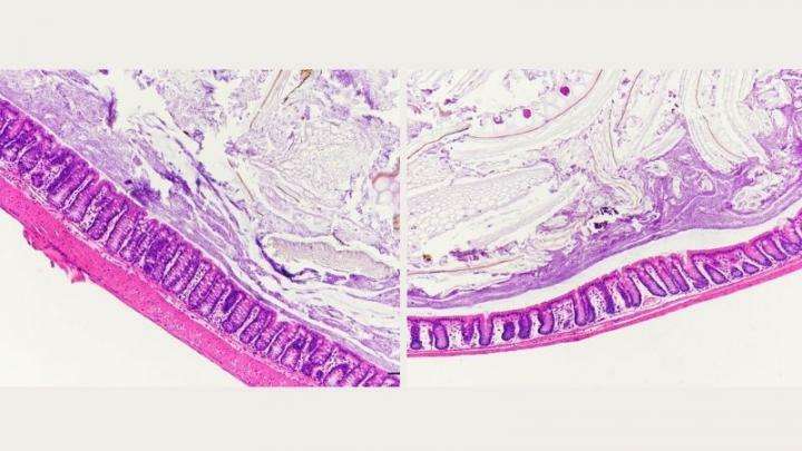 Диета с высоким содержанием сахара спровоцировала воспаление кишечника Диета с высоким содержанием сахара спровоцировала воспаление кишечника