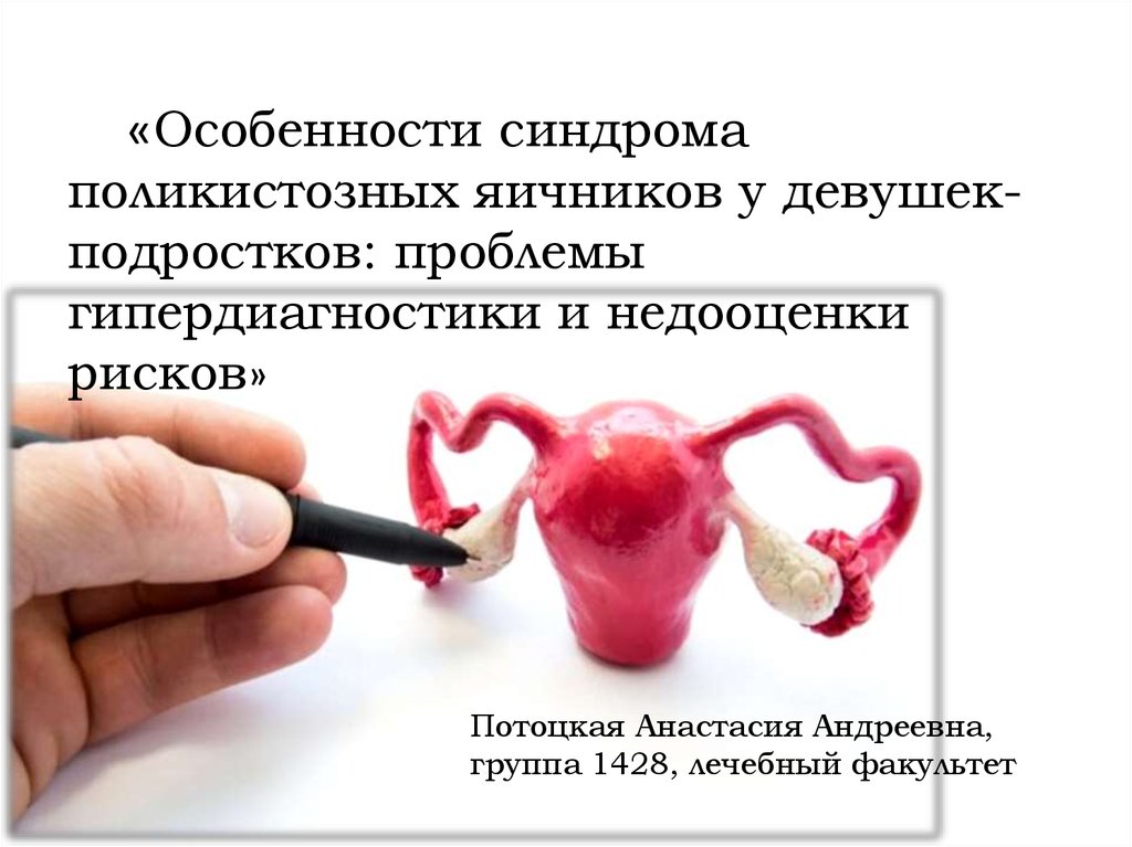 Синдром гипердиагностики