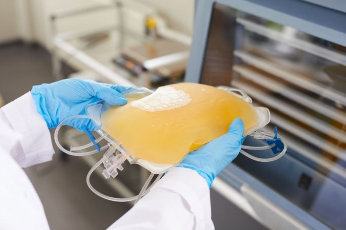 Правительство утвердило концепцию роста заготовки плазмы крови для производства лекарств Правительство утвердило концепцию роста заготовки плазмы крови для производства лекарств